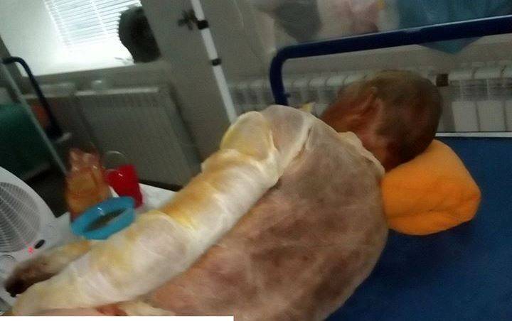 Выбил окно и тащил дедушку на улицу. В Харькове всем миром спасают подростка, который чудом выжил при пожаре