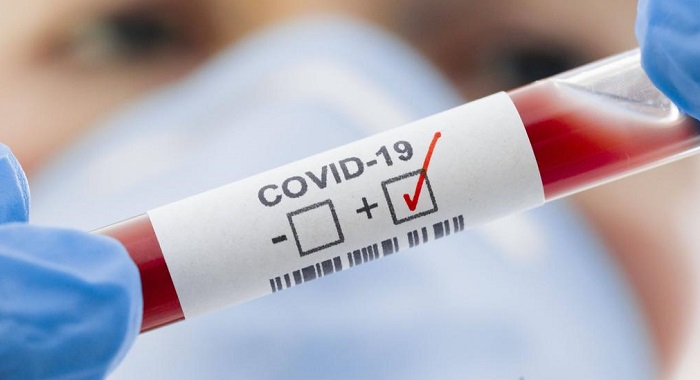 Троє мешканців Харківщини захворіли COVID-19
