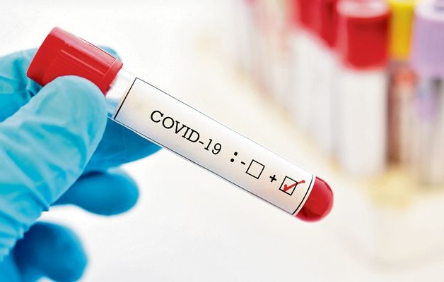 За добу 10 мешканців Харківщини захворіли COVID-19